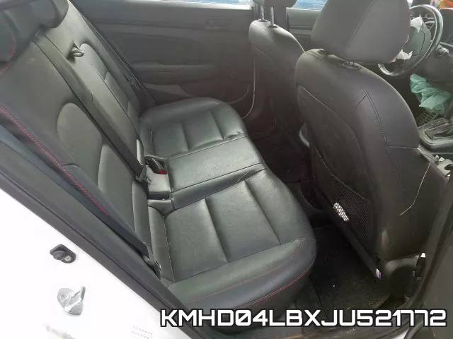 KMHD04LBXJU521772 фото 7