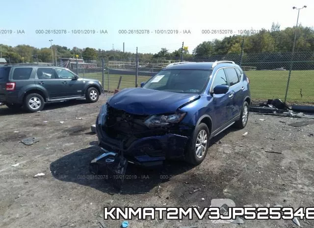 KNMAT2MV3JP525348 фото 3
