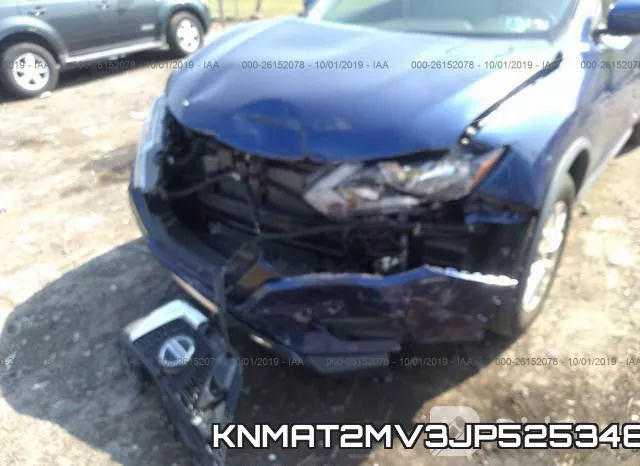 KNMAT2MV3JP525348 фото 7
