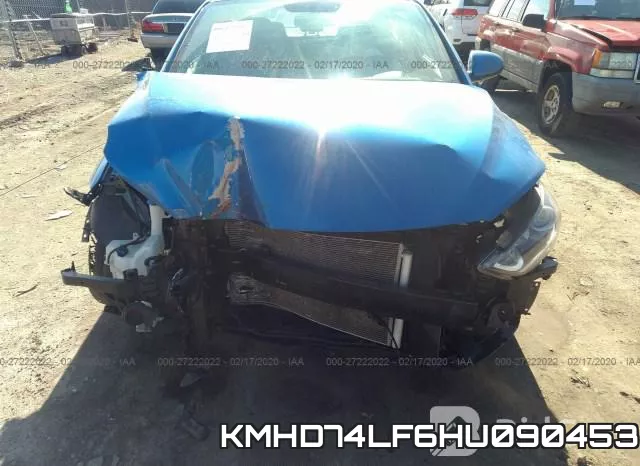 KMHD74LF6HU090453 фото 7