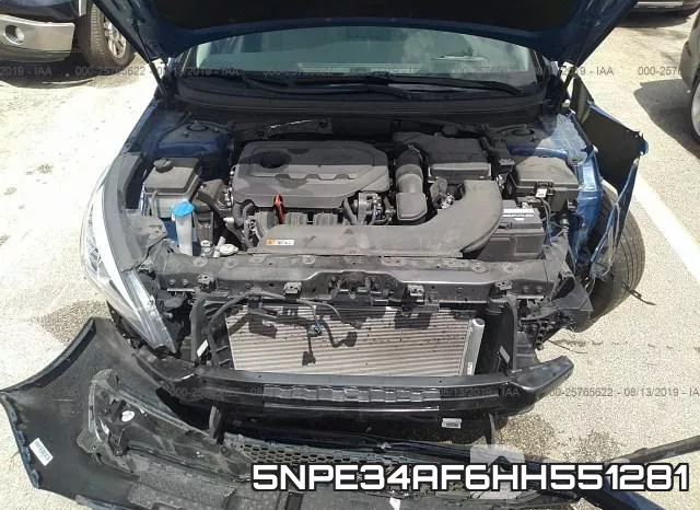 5NPE34AF6HH551281 фото 2