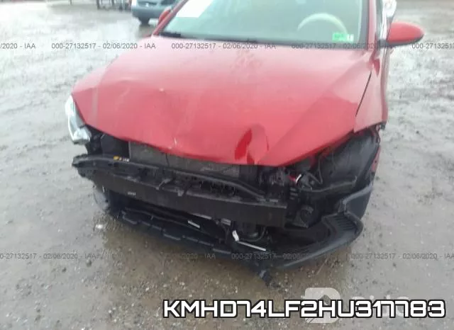 KMHD74LF2HU317783 фото 7