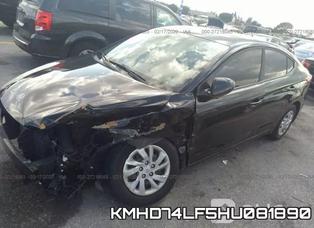 KMHD74LF5HU081890 фото 7