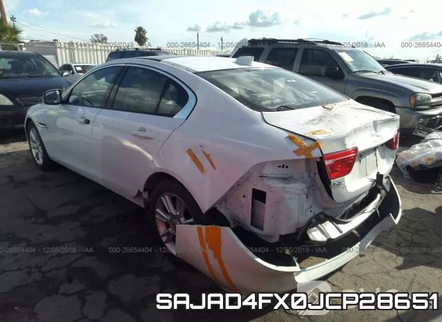 SAJAD4FX0JCP28651 фото 4