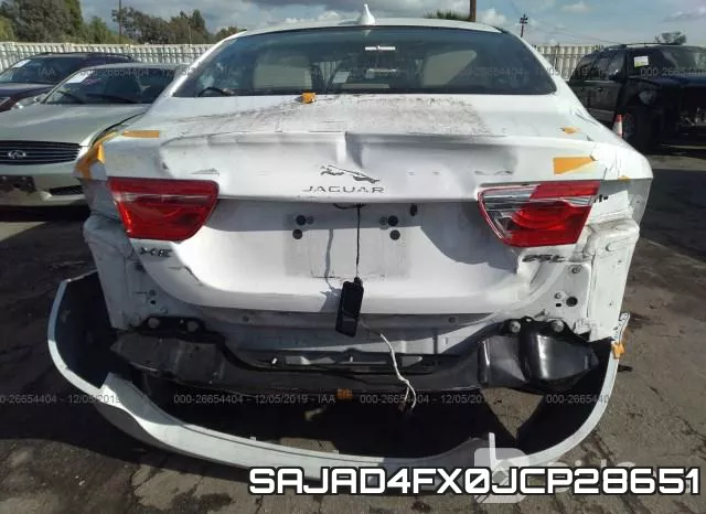 SAJAD4FX0JCP28651 фото 7