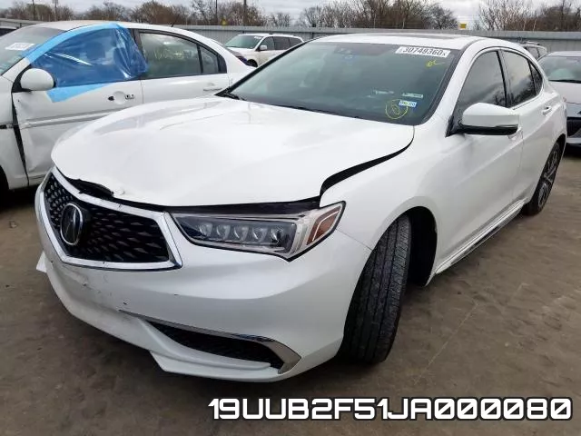 19UUB2F51JA000080 фото 3