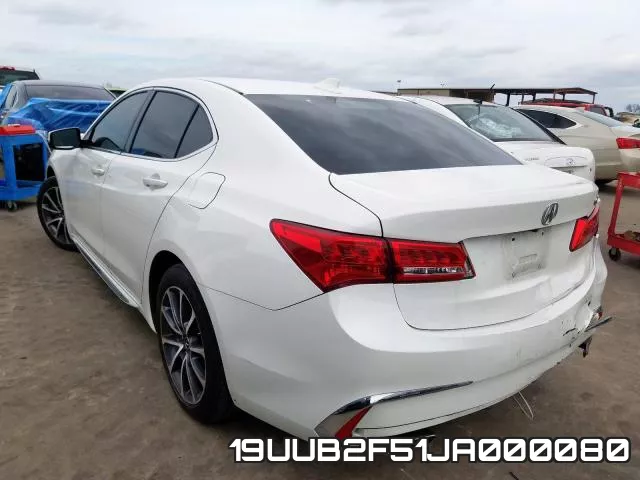 19UUB2F51JA000080 фото 4