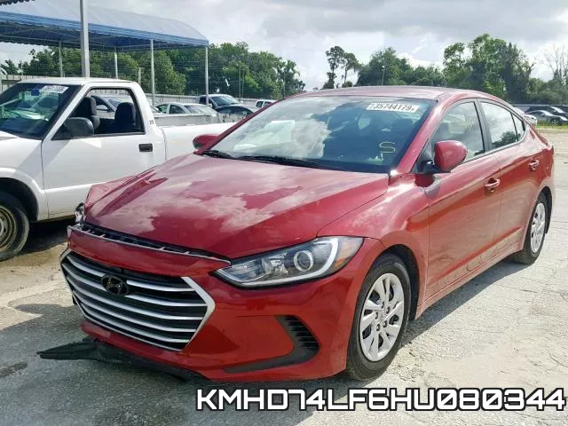 KMHD74LF6HU080344 фото 3