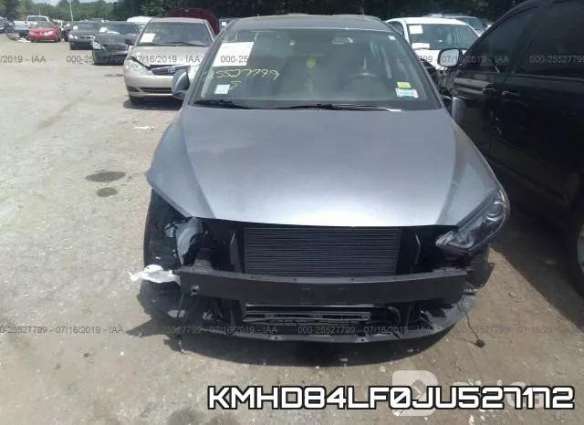 KMHD84LF0JU527172 фото 7