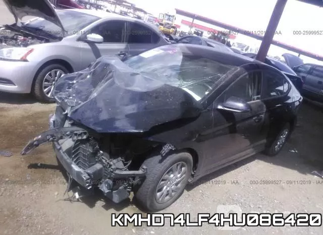 KMHD74LF4HU086420 фото 3