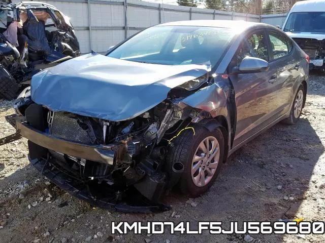 KMHD74LF5JU569680 фото 3