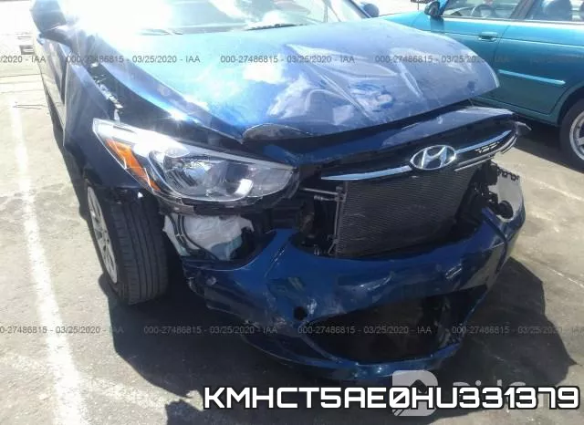 KMHCT5AE0HU331379 фото 7