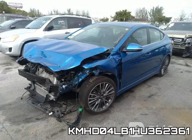 KMHD04LB1HU362361 фото 3