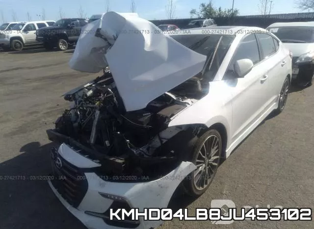 KMHD04LB8JU453102 фото 3
