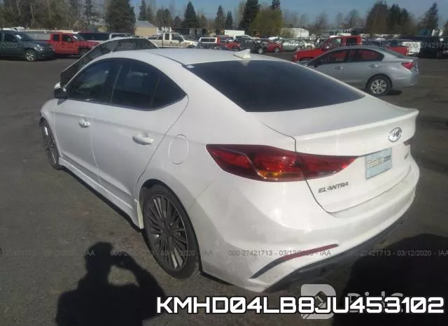 KMHD04LB8JU453102 фото 4