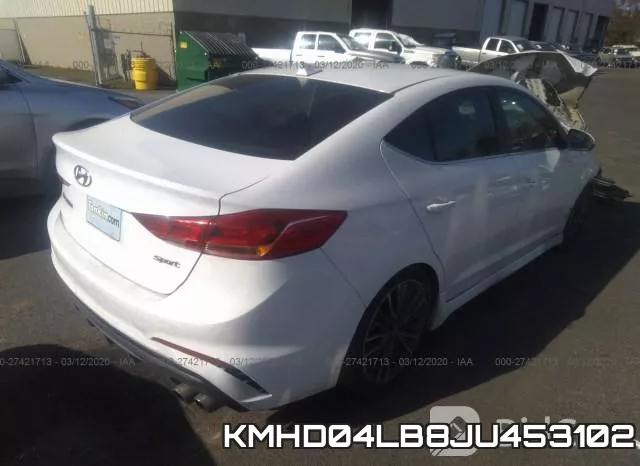 KMHD04LB8JU453102 фото 5