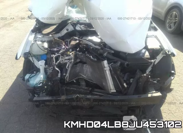 KMHD04LB8JU453102 фото 7
