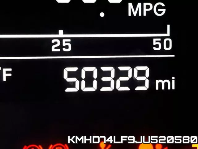 KMHD74LF9JU520580 фото 9