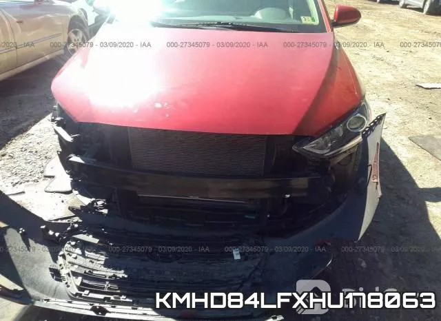 KMHD84LFXHU178063 фото 7