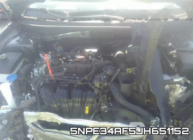 5NPE34AF5JH651152 фото 2