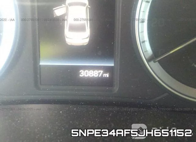 5NPE34AF5JH651152 фото 8