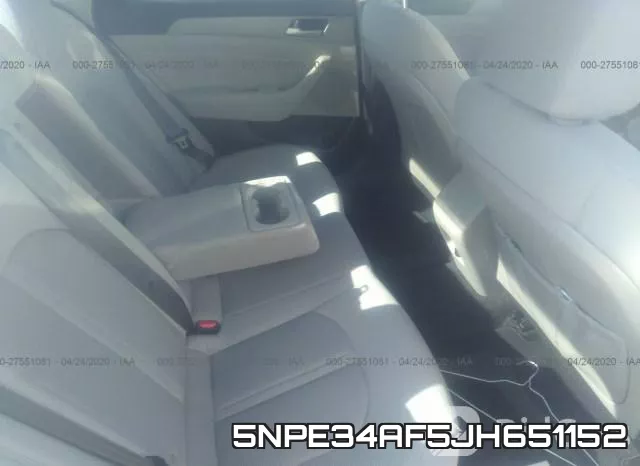 5NPE34AF5JH651152 фото 9