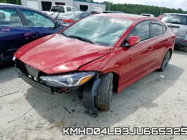 KMHD04LB3JU665325 фото 3
