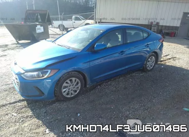 KMHD74LF3JU607486 фото 3