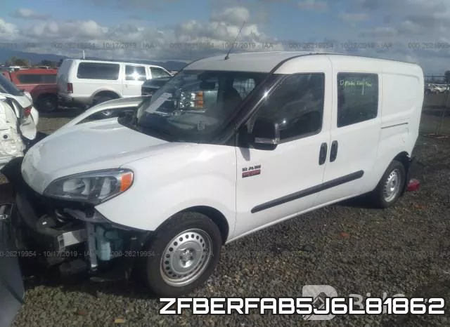ZFBERFAB5J6L81862 фото 3