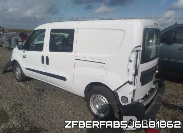 ZFBERFAB5J6L81862 фото 4