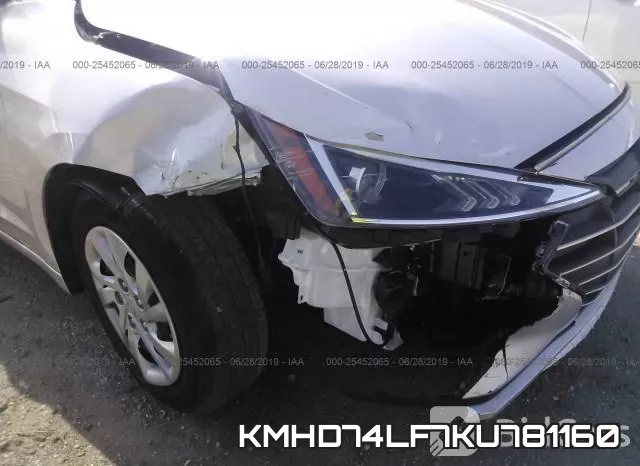 KMHD74LF7KU781160 фото 7