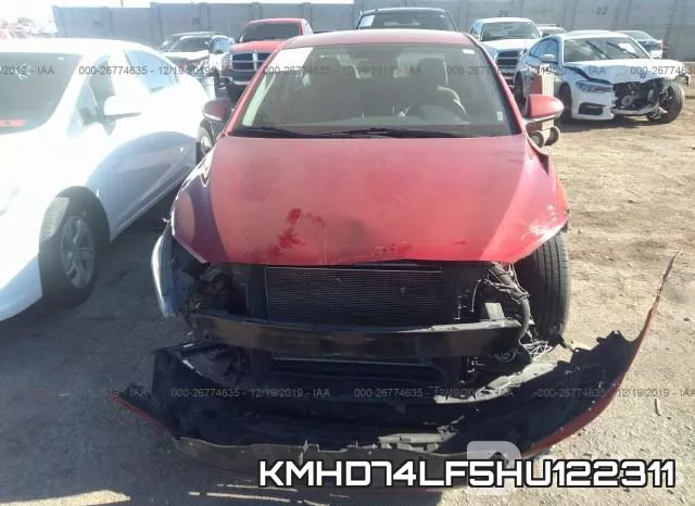 KMHD74LF5HU122311 фото 7