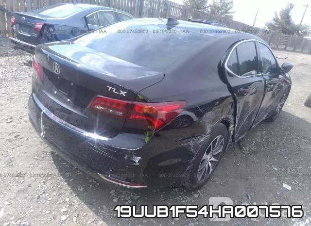 19UUB1F54HA007576 фото 5