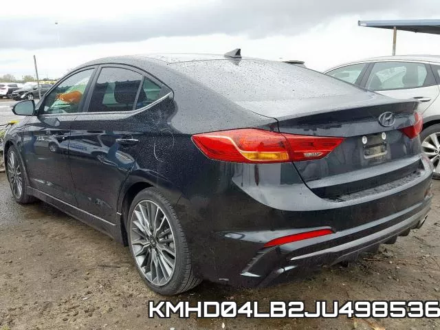 KMHD04LB2JU498536 фото 4