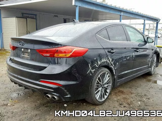 KMHD04LB2JU498536 фото 5