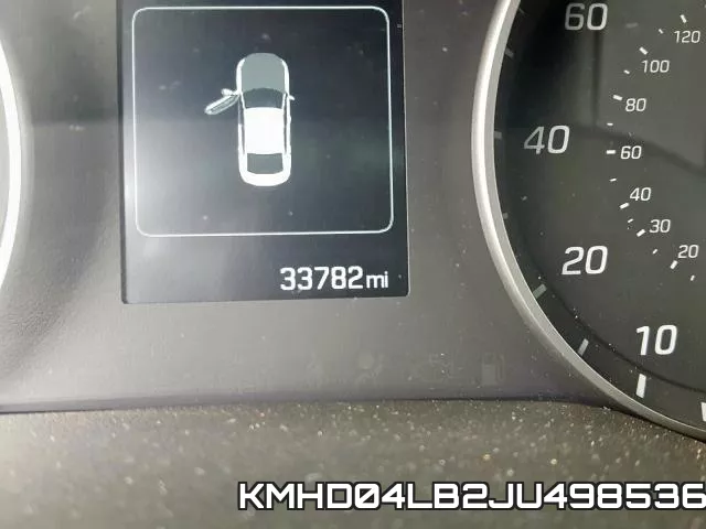 KMHD04LB2JU498536 фото 9