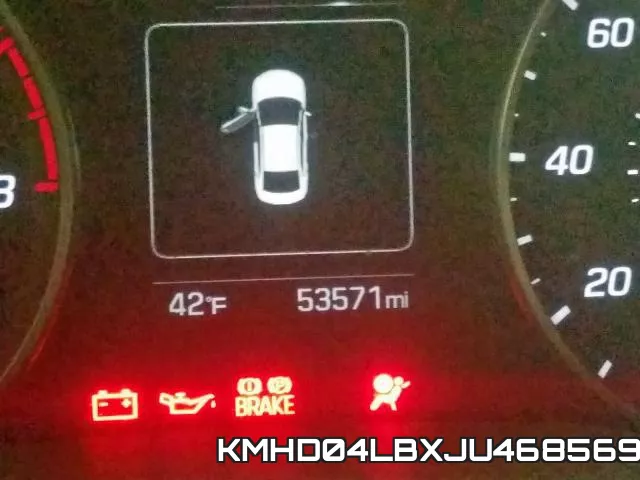 KMHD04LBXJU468569 фото 9