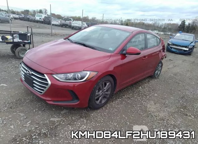 KMHD84LF2HU189431 фото 3