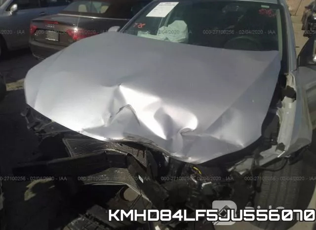 KMHD84LF5JU556070 фото 2