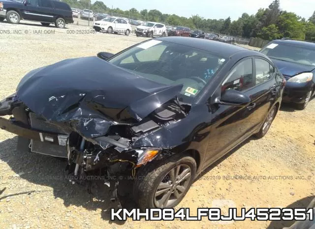 KMHD84LF8JU452351 фото 3
