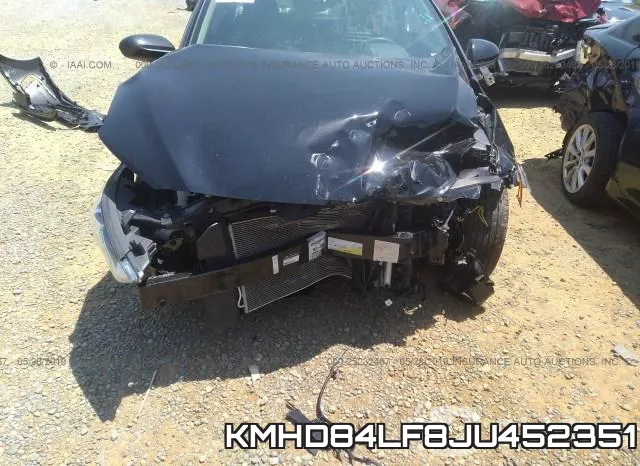 KMHD84LF8JU452351 фото 7