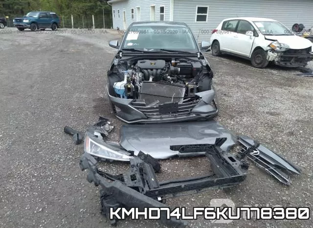 KMHD74LF6KU778380 фото 7
