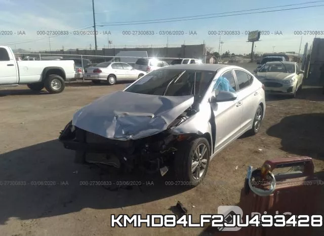 KMHD84LF2JU493428 фото 3