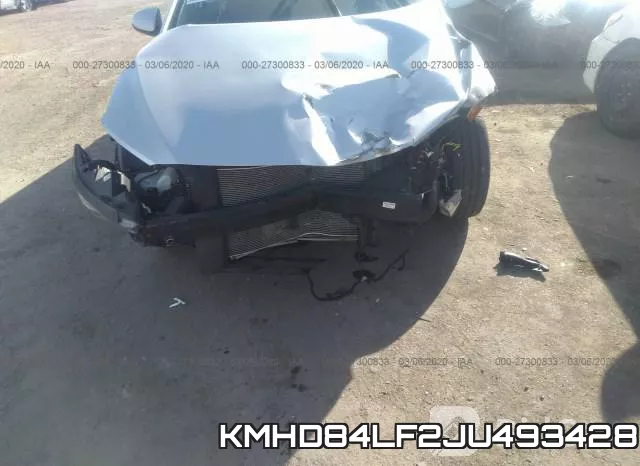 KMHD84LF2JU493428 фото 7
