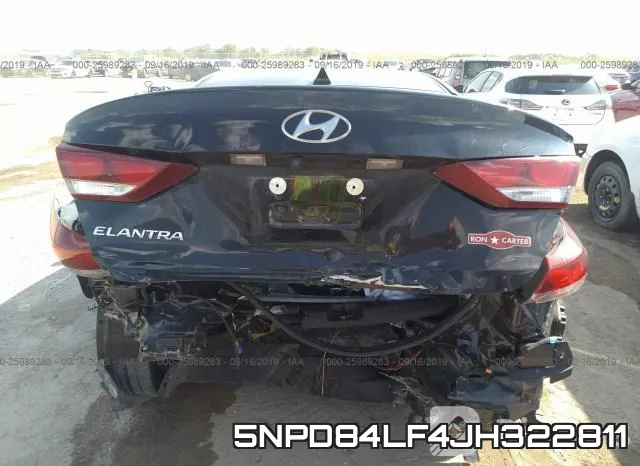 5NPD84LF4JH322811 фото 7