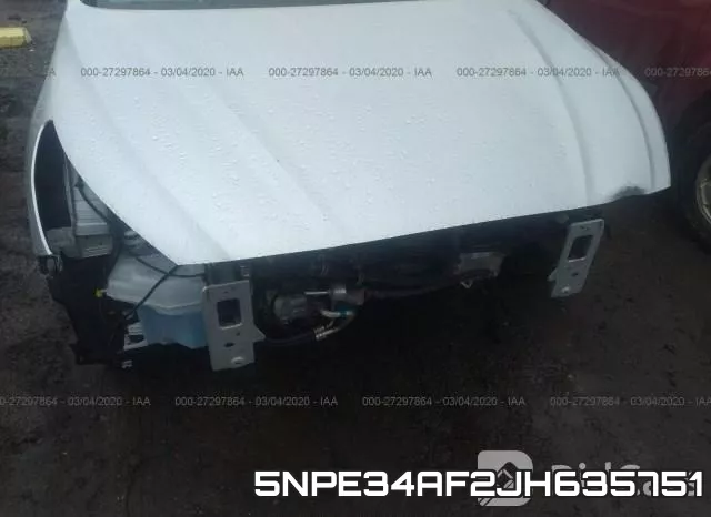5NPE34AF2JH635751 фото 7