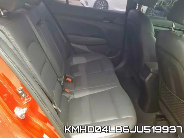 KMHD04LB6JU519937 фото 7
