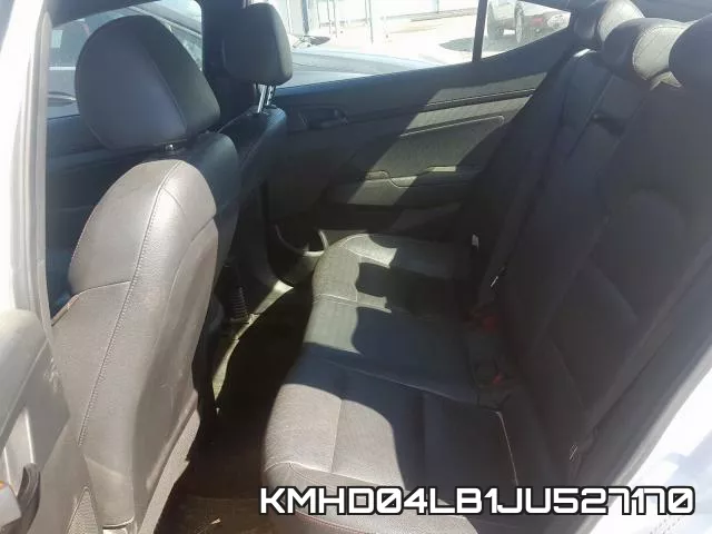 KMHD04LB1JU527170 фото 7