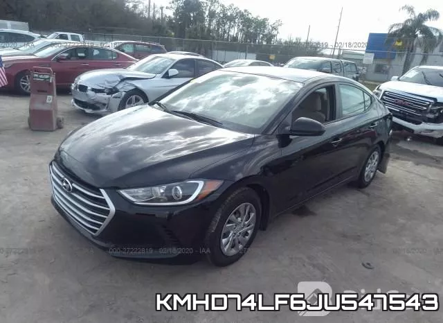 KMHD74LF6JU547543 фото 3