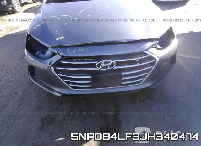 5NPD84LF3JH340474 фото 7